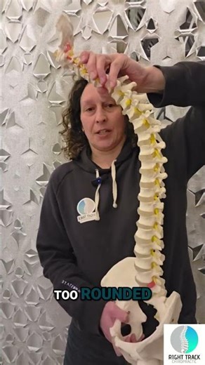 Fix Your Rounded Upper Back: Posture Correction Guide #shorts