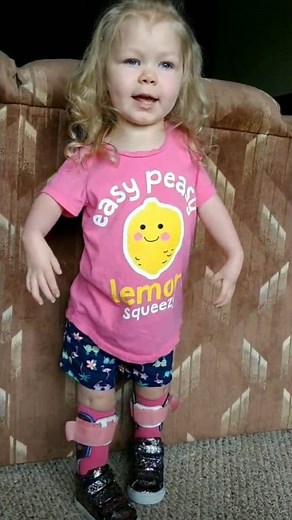 22K views · 1.1K reactions | Day 24 Arthrogryposis Awareness - #arthrogryposis #amcana #awarenessmonth #june2023 #amceducation #amcstrong #amcstory #medicaljourney #easypeasylemonsqueezy | Team AMC Ana | Facebook