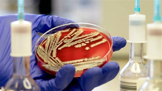 E. coli outbreak: How to protect yourself from infections, bacteria?