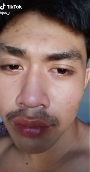 อยากดัดฟัน #ชายรักชาย #คบตุ๊ดคบกะเทย