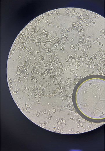 Paramecium: O Estranho Protozoário na Urina