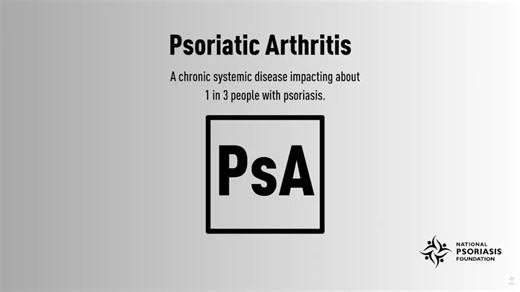 What to Know About Psoriatic Arthritis