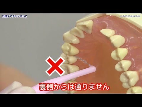 歯間ブラシの正しいブラッシング方法 口腔ケアチャンネル 372（口腔ケアチャンネル2 #045）