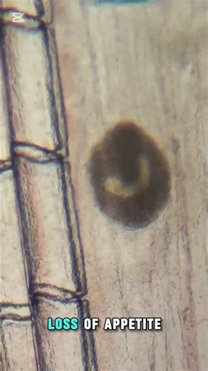Gyrodactylus#monogenean#parasite#infections#fluke#worm#fish#parasite#parasitology