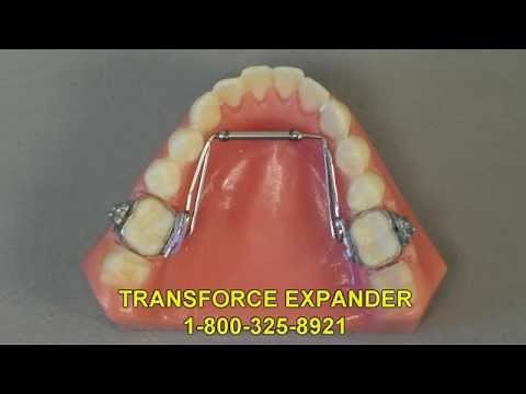 TransForce Expander Appliance | Arch Expander Appliance