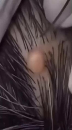 😱 You won't believe what came out of this one... #pimplepop #satisfying | Rescue Poor Animals