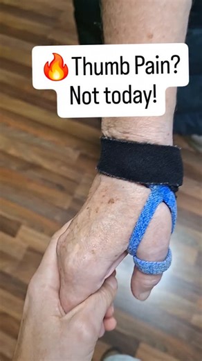 Andrea Moser on Instagram: "A simple Orficast splint – quick to make, powerful in effect. It supports the CMC joint, reduces pain, and gives your hand the stability it needs for everyday use. Small splint, big impact. ✨🖐️ Seen at my colleague @kirigru – love this idea! #handtherapy #ergotherapie #occupationtherapy #surgeons #physiotherapy"