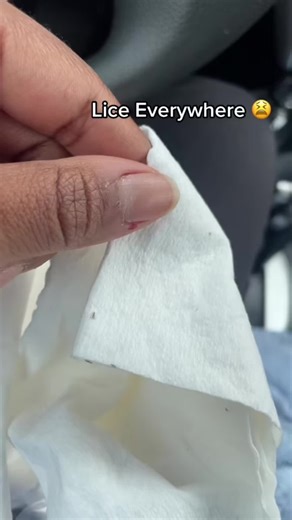 Effective Head Lice Treatment and Removal Services