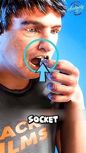 Knocked Out a Tooth? 😳 DO THIS FAST to Save It!