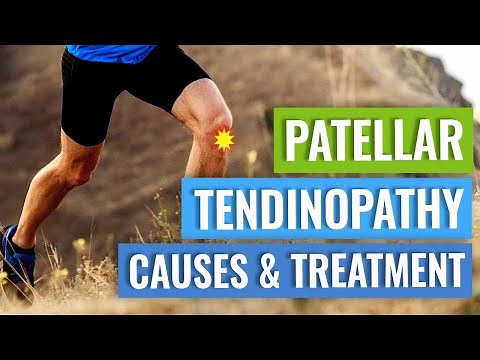 Get Relief from Patellar Tendinopathy with these Exercises