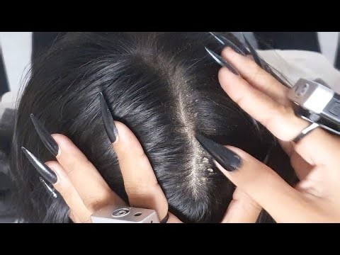 Slow & Gentle Itchy Scalp ASMR 🌜 | Long Nail Scratching + Flake Detail #VF0150