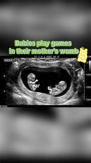Exploring Fetal Movement in the Womb