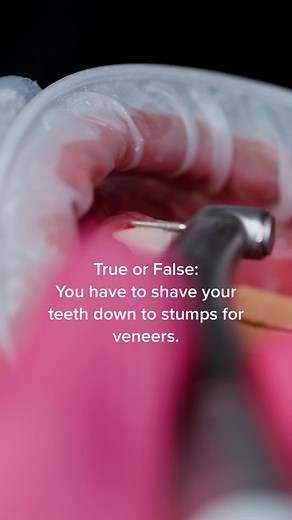 Do You Need to Shave Your Teeth Down for Veneers?