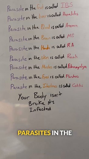 Parasites aren’t just a third-world problem. They’re a modern health problem hiding in plain sight. They can live in your gut, brain, liver, lungs, even your eyes… and most people don’t even know they’re there. 👉 Symptoms like bloating, fatigue, skin issues, or “IBS” might be parasitic. And here’s the wild part: It’s not about where you’ve traveled. It’s about how well your immune system, gut, and drainage pathways are doing their job. 👇 Comment “BUGS” and we’ll send you a free guide on parasi