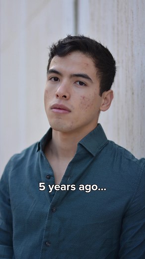 5 Years Glow Up: 2017 vs 2022 Transformation Story