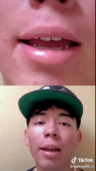 Captivating Expressions: Yawning and Character Design