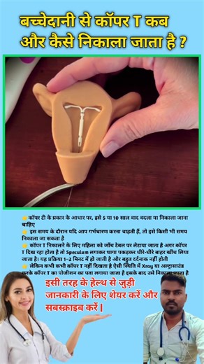 बच्चेदानी से कॉपर T कब और कैसे निकाला जाता है ? Copper Tube removal process || #viral #coppertube