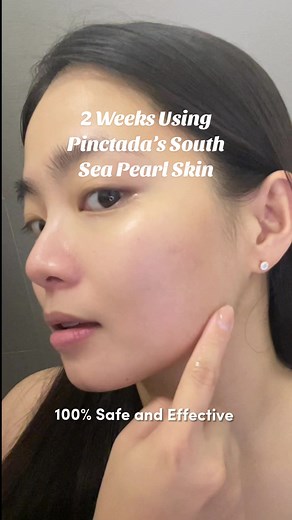 2 weeks since I started using @Pinctada South Sea Pearl Skin and grabe yung skin transformation ko. From having Oily, Bumpy and with Dark Pimple Marks to Smooth, Glowing and Radiant skin like South Sea Pearls real quick! So happy to discover this FDA ASEAN and HALAL INTL Certified skincare products that is made of 100% Real South Sea Pearl from Palawan! Trust me sobrang luxurios at premium ng skincare set na ‘to. Worth every money and quality and effect sa skin ko ✨🫶🏻🫰🏻👏🏻 #pinctadasouthsea