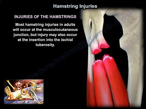 Hamstrings Injuries - Everything You Need To Know - Dr. Nabil Ebraheim
