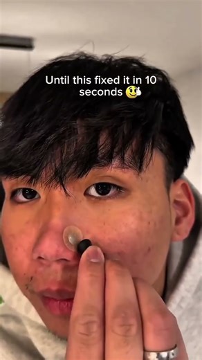 This Nose Clip Actually Works 👃✨ Breathe Better Instantly