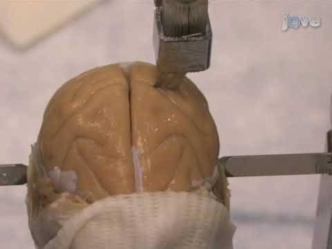 Brain Dissection in Stereotaxic Space: Non-human Primates