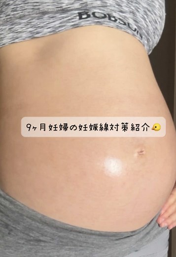 妊娠線予防のための保湿ケア方法