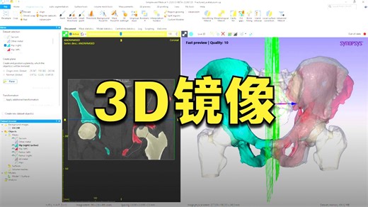 【Simpleware】Y-2026.03 镜像工具
