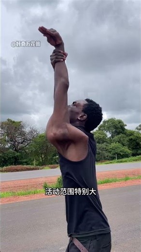 Why does a dislocation hurt so much? #Science #Dislocation #HighEnergy #KnowledgeBoost