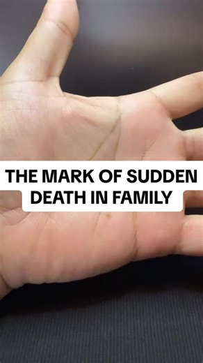 The Mark of Sudden Death in Family According to Palmistry