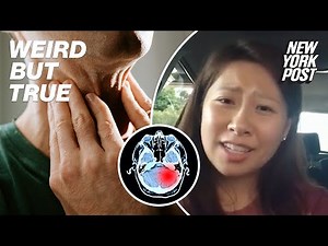 What is 'foreign accent syndrome'? 9 shocking cases | Weird But True