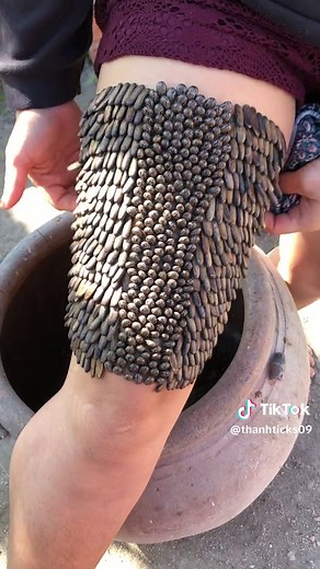 Her feet were full of ticks #lice #fyp #foryou