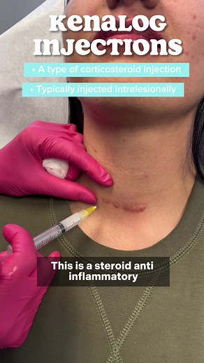Keloid Scar Treatment: Kenalog Injection & Microneedling