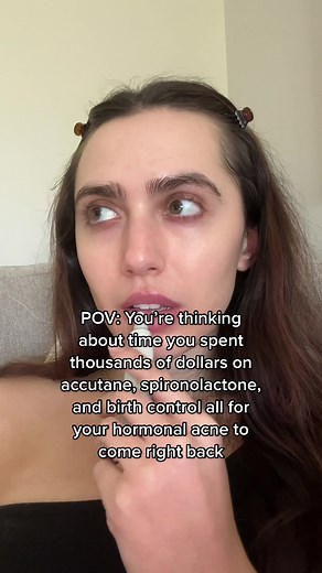 Hormonal Acne Solutions: Root Causes and Clearing Journey