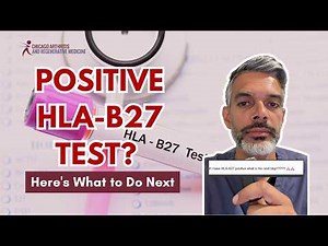 Positive HLA-B27 Test? Here's What to Do Next