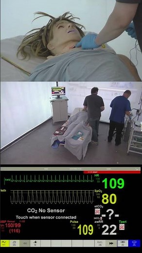 Post-Thyroidectomy Haematoma – Emergency Airway Simulation