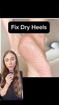 Fix Dry Cracked Feet FAST | Dermatologist Tips
