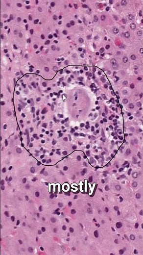 ANOTATING BIOPSIES: A Pathologist Perspective