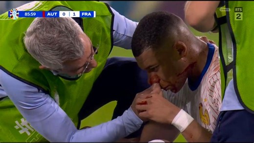 La blessure impressionante de Mbappé
