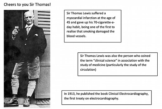 Slow Atrial Fibrillation or Complete Heart Block: Lewis lead to the rescue