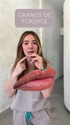 ¿Qué son los Fordyce? Descubre todo sobre las glándulas sebáceas en los labios