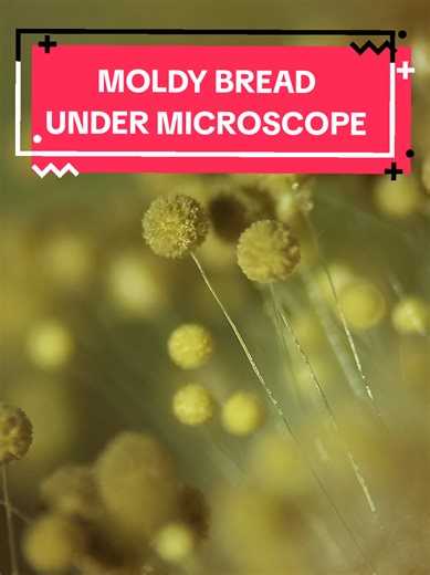 MOLDY BREAD UNDER MICROSCOPE 🔬 #microbiology #mycology #mold #microscope