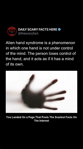Thescaryfact ™ on Instagram: "Alien hand syndrome is a rare neurological condition where one hand moves without the person’s conscious control. The affected hand may grab objects, interfere with tasks, or even act against the person’s intentions. Patients often describe the hand as having “a mind of its own.” The condition is usually linked to brain surgery, strokes, or damage to the corpus callosum — the structure that connects the brain’s hemispheres. 👉 Follow @thescaryfact for when your own