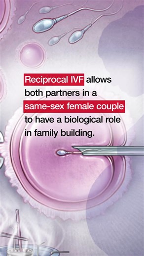 A new study published in JAMA examined reproductive outcomes for same-sex female couples using reciprocal versus autologous #IVF. After adjustment for key clinical factors—including patient and partner age, #infertility diagnosis, and use of preimplantation genetic testing—there were no significant differences between the two groups in rates of clinical pregnancy and live birth. The adjusted risk ratios for clinical pregnancy and live birth indicate broadly equivalent outcomes. These findings co