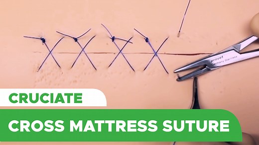 84K views · 1K reactions | Interrupted Cruciate or Cross Mattress...