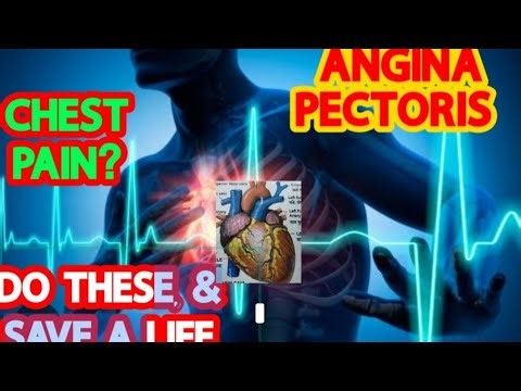 Angina Pectoris - An Approach To Chest Pain & Acute Coronary Syndrome