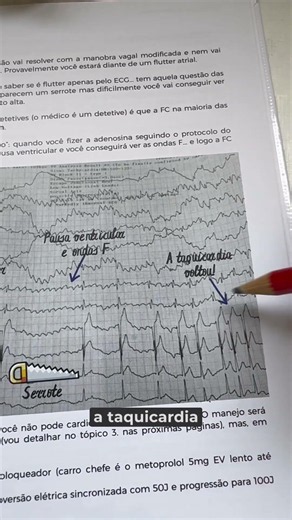 Patient with suspected supraventricular tachycardia. Check out "The ECG Bible," link in the descr...