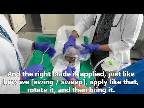 Obstetric Forceps and Ventouse Application Simulation