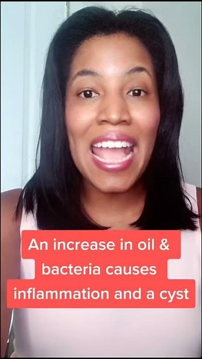 What causes hormonal acne? #shorts