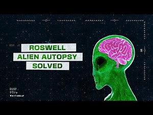 Roswell: Alien Autopsy Solved | Full UFO Documentary | Aliens | FREE4ALL