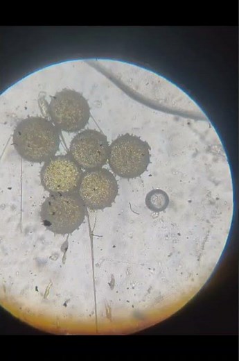 🔬 Amazing View of Pollen Grains Under Microscope | Microscopic World of Plants